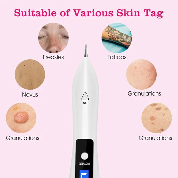 Portable Skin Tag Repair Kit - 9-Level Adjustable Electric Mole Remover