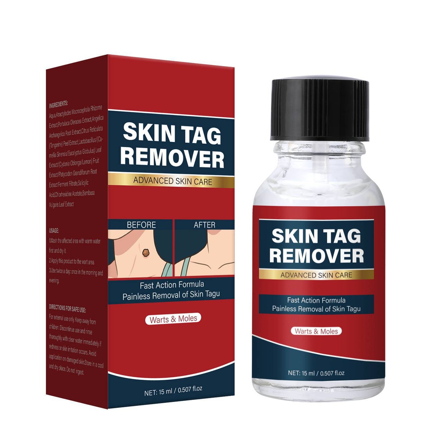 Dermatophytes Remover for Skin and Body Care - 15ml Vegetation Remover Tool