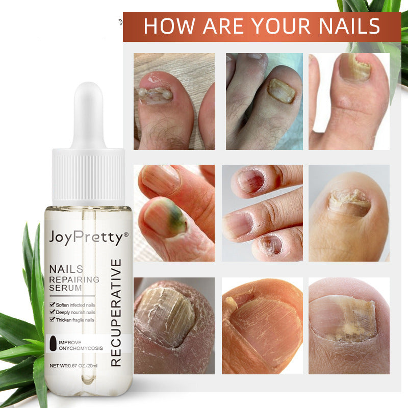 Nourishing Nail Polish Bright Yellow & White - 20ml