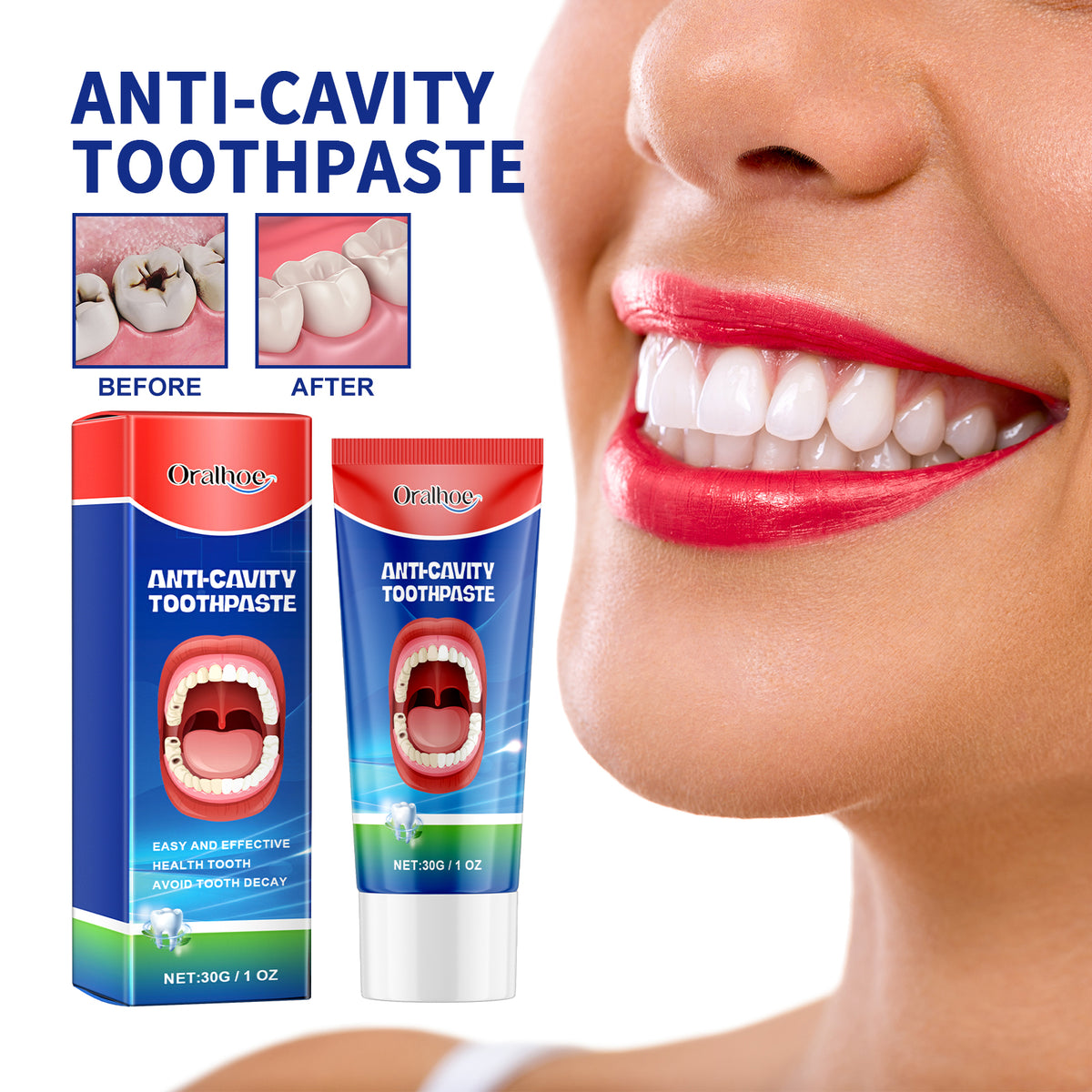 Anti Cavity Toothpaste 30g - Whitens, Repairs & Freshens Breath