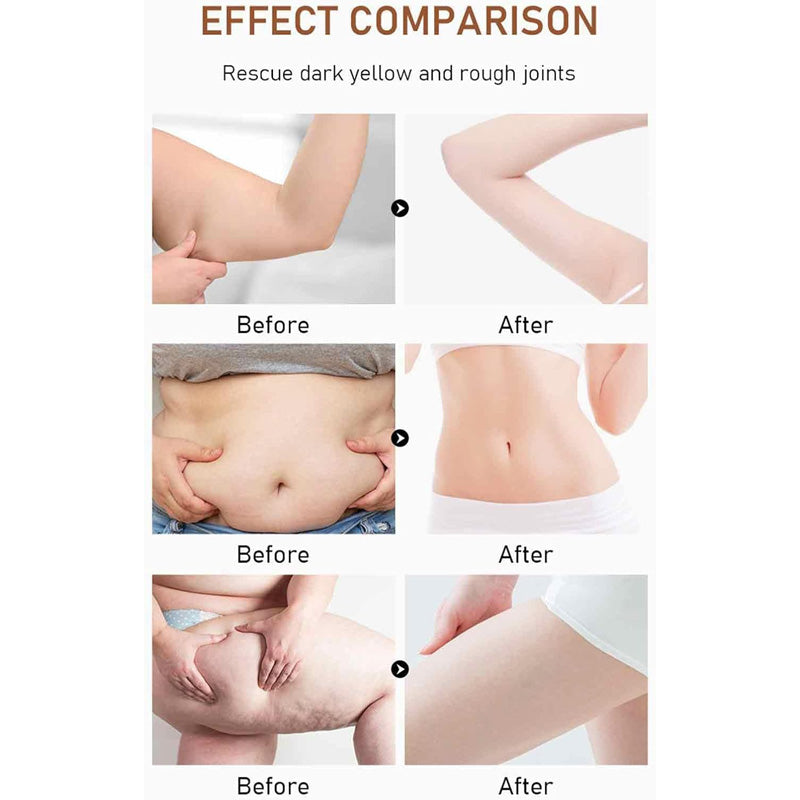 Natural Slimming Massage Oil, 30ml Belly Drainage and Body Sculpting Oil