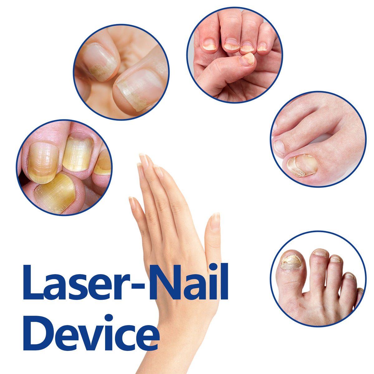 Nail Care Phototherapy Device for Soft Nail Repair - 1 Piece