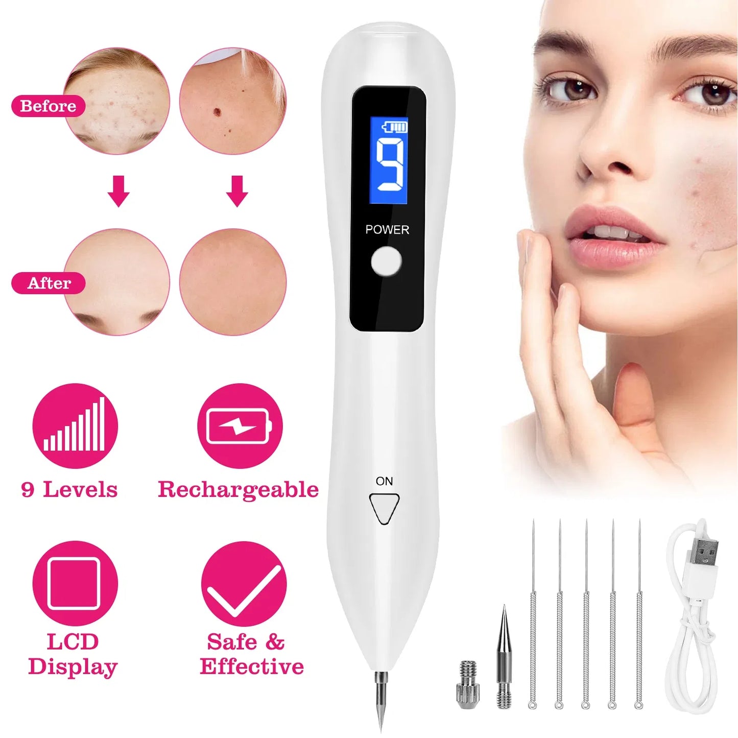 Skin Tag and Mole Removal Pen - 9 Adjustable Intensity Levels, USB Rechargeable