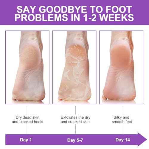 Foot Peeling Mask 5 Pack, Moisturizing Socks for Dry Foot Care, Hydrating Feet Peel Masks Repair Dry Cracked Heels, Remove Dead Skin,Callus - Women Men (Lavender)