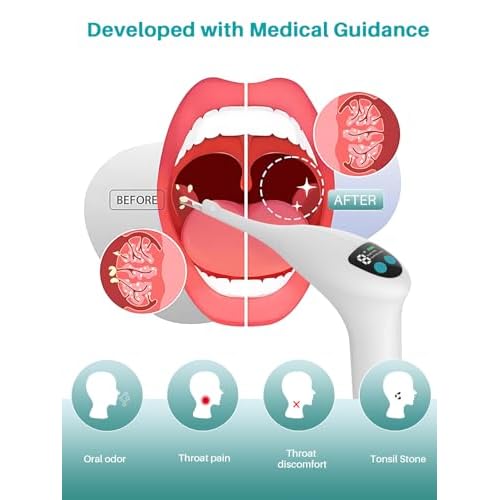 Voraiya Electronic Tonsil Stone Remover, Visible Tonsil Camera, Tonsil Stone Removal Kit with Camera and Led Light, APP WiFi Connection, Tonsil Stone Vacuum with 5 Level Oral Suction Device