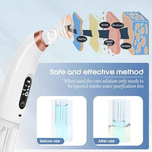 Blackhead Remover Vacuum - Water Cycle Facial Pore Cleaner with 3 Adjustable Suction Power 6 Probes USB Rechargeable - Blackhead Extractor Tool Kit for Women & Men