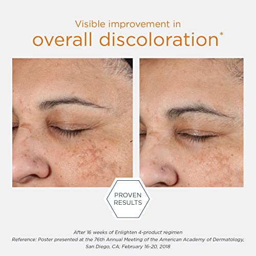 NEOSTRATA Pigment Controller Brightening Face Treatment with Retinol, Vitamin C. Oil-free, 1.7 fl oz