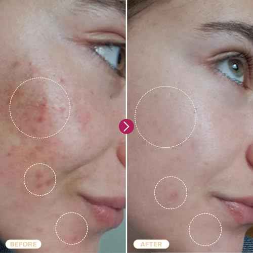 BASE LABORATORIES Hypochlorous Acid Spray for Face & Skin | 8oz | Facial Spray Daily Skin Repair Solution for Sensitive Skin, Redness, Irritations, Eczema | Hypochlrous HOCL Molecule | 2PK