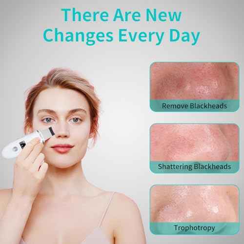 Face Scrubber Skin Spatula - Blackhead Remover Deep Cleansing Tool for Pore Extraction, 4-in-1 Fast Charging Dock Blackhead Remover Face Spatula for Facial Skincare Women Gift (White)