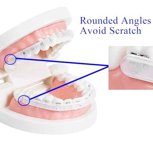 Comfort Cover for Braces, Lip Protector Mouth Guard Lip Cushion Teeth Shield Bumper for Brackets, Aligner, Dental Wax Alternative, Hard and Rigid Clip, in Portable Storage Case with Mirror