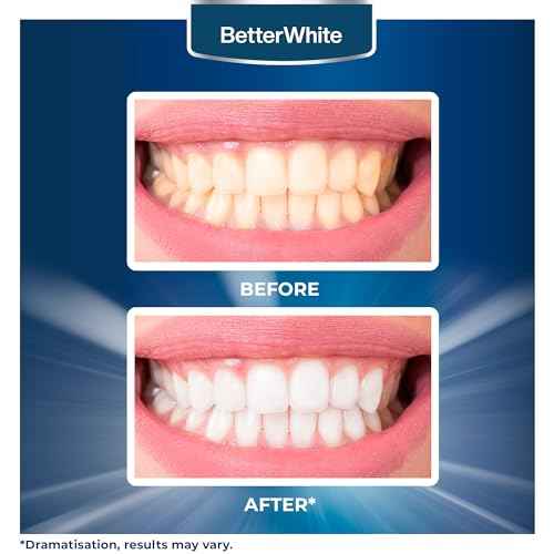 Teeth Whitening Powder - Hydroxyapatite, Remineralizing, Non-Sensitive Formula - Dentist-Approved Tooth Stain Remover & Polisher - Fluoride-Free (30 Grams)