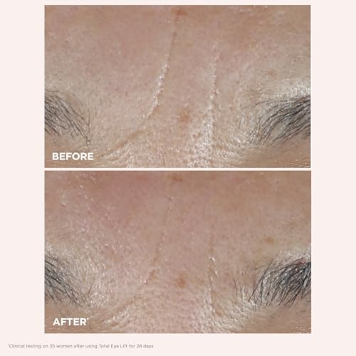 Clarins NEW Total Eye Lift | Anti Aging Eye Cream | Targets Wrinkles, Crow's Feet, Dark Circles and Puffiness For a Visible Eye Lift in 30 Seconds | REFILLABLE