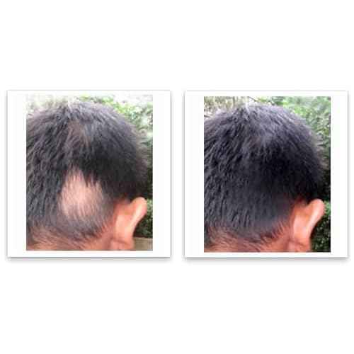 Caboki 10X Volumizing Hair Powder for Thinning Hair: Root Touch Up for Men and Women, Fill in Hairline & Edges, Cover Bald Spots. TALC-Free, Dark Gray