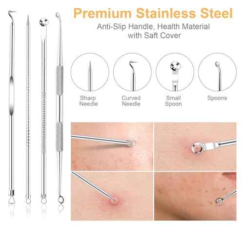9 PCS Blackhead Remover Tools, Pimple Popper Tool Kit & Comedone Extractor - Professional Acne, Zit, Blemish & Whitehead Removal for Face & Nose, with Stainless Steel Tweezers & Travel Case, UUBAAR