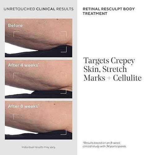 Murad Retinal ReSculpt Body Treatment – Encapsulated Retinal, Shea & Avocado Extract Body Cream to Firm, Lift, and Smooth Crepey Sagging Skin, Targeting Cellulite and Stretch Marks Nightly – 5.0 Fl Oz