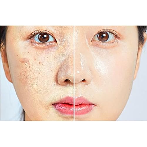 (85%) Human Stem Cell & (10%) PDRN Anti-Aging & Repair Ampoule Serum (12 Vials, 120ml) for Youthful, Radiant Skin!