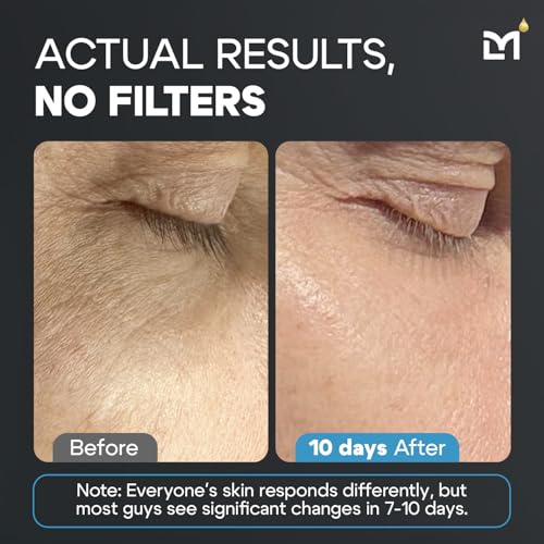 Titan Anti-Aging Mens Skin Care Kit ? Cleanser, Face Serum, Mens Face Moisturizer ? Men, Skin Care Set ? Dark Spots, Wrinkles, Fine Lines ? Vitamin C, Niacinamide, Ceramides, HA ? Unscented