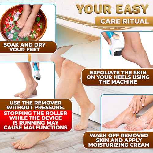 Foot Callus Remover Tool | Batteries Not Included ? High-Speed Foot Grinder with Easy-to-Replace Roller ? On-The-Go Electric Callus Remover for Feet | Pedicure Tools for Feet Smoothing