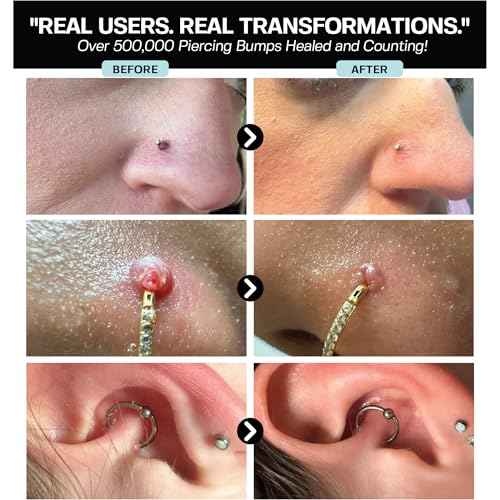 BASE LABORATORIES Piercing Aftercare Hypochlorous Acid Spray PRO - 8 OZ | Ear Piercing Cleaner | Saline Solution Piercing Aftercare - Saline Spray for Piercings, Bumps & Keloids | Ear, Nose, Belly