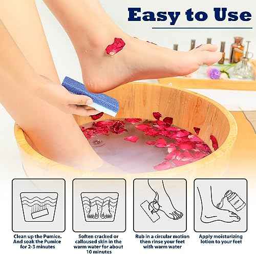 6 Pack Foot Pumice Stone for Feet Callus Remover, EWAGOA Pedicure Tools for Feet, Foot Exfoliator and Foot Scrubber Dead Skin Remover Cracked Heel Repair (6-Blue)