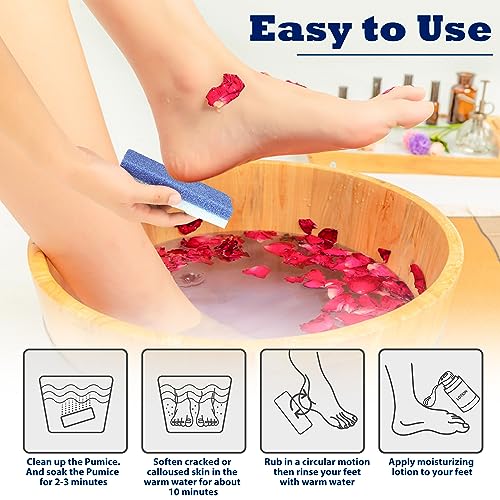 6 Pack Foot Pumice Stone for Feet Callus Remover, EWAGOA Pedicure Tools for Feet, Foot Exfoliator and Foot Scrubber Dead Skin Remover Cracked Heel Repair (6-Blue)