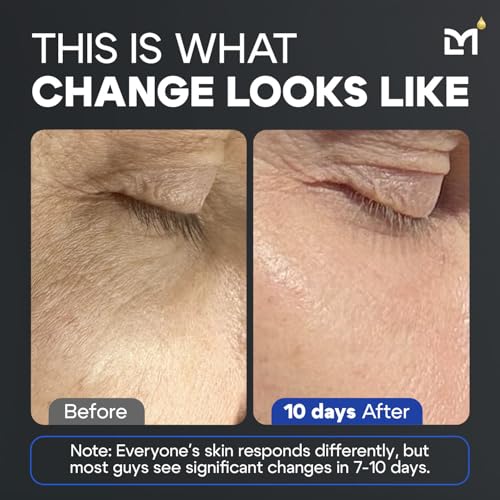 Titan Anti-Aging Peptides Serum for Face ? High Potency Mens Peptide Serum Moisturizer ? Mens Skin Care ? Men, Dark Spots, Wrinkles, Fine Lines ? Peptides, 5% Niacinamide, HA ? Unscented