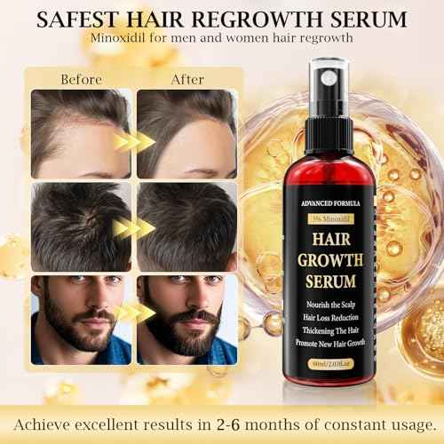 5% Minoxidil for Men/Women Hair Growth Serum Spray,Thinning Hair Loss/Regrowth Treatment for Women/Men,Minoxidil for Men¡¯s Beard,Contain Rosemary Oil,Batana Oil for Hair Growth,Gentler,Refreshing 60ml