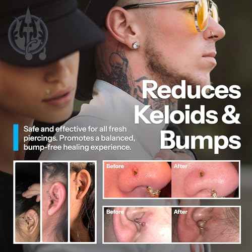 H2Ocean Piercing Aftercare Spray and Keloid Bump Removal? Sea Salt Spray for Body and Facial Piercings ? Ear, Nose, Navel, Oral & Body Piercing Cleaner, Aftercare Solution for New Piercings? 4oz