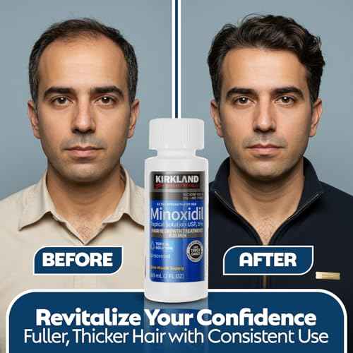 Minoxidil For Men 5% Topical Solution For Hair Regrowth Treatment 6 Month Supply 6 X 2 Fl Oz With A Braidz Comb