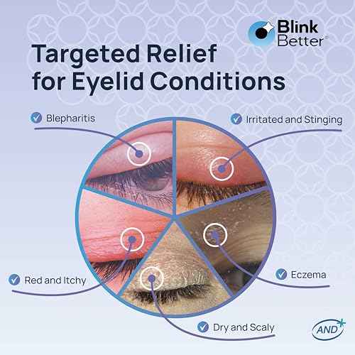 BetterLids Eyelid Ointment ? Intense Oat Complex with Shea Butter & Panthenol - Hydrates, Nourishes & Soothes ? Moisturizing Care for Dry, Itchy, Red, Sensitive, Flaky Skin Around the Eyes - 0.35 oz