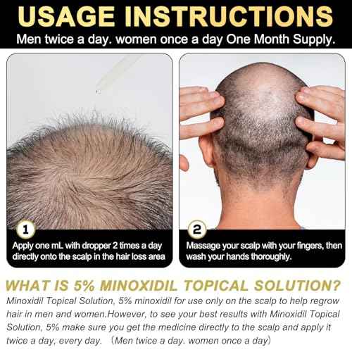5% Minoxidil for Men and Women Hair Growth Serum, Biotin Hair Growth, Hair Regrowth Treatment for Scalp Hair Loss Hair Thinning for Thicker Longer Fuller Healthier Hair (Pack of 1)