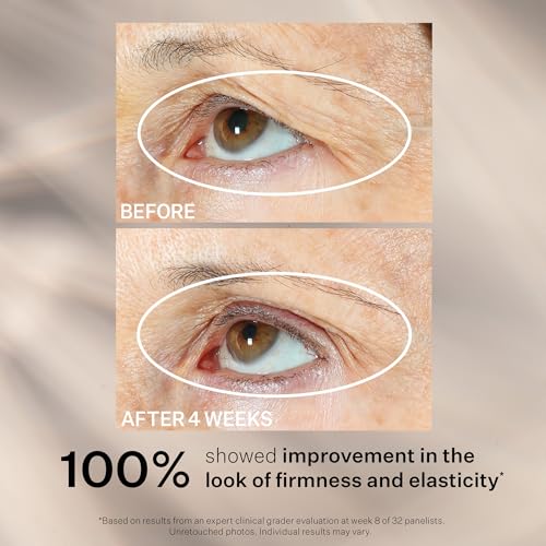 StriVectin Tighten & Lift Peptight Face Lift Serum with Tightening & Brightening Peptides for Wrinkles