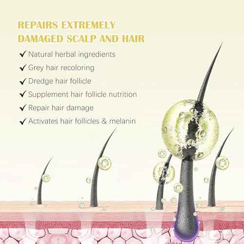 5% Minoxidil for Men and Women Hair Growth Oil, Minoxidil Hair Growth Serum Infused with Biotin for Hair Regrowth Treatment, Scalp Hair Loss Hair Thinning, Natural Hair Growth 2.02 oz