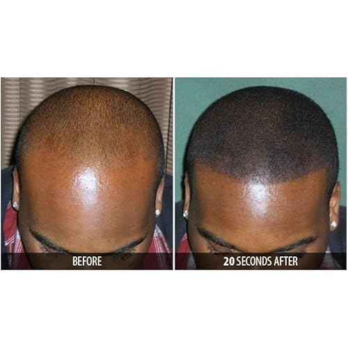 Dr. Yates MD Keratin Fiber Hair Enhancer (Dark Blonde)