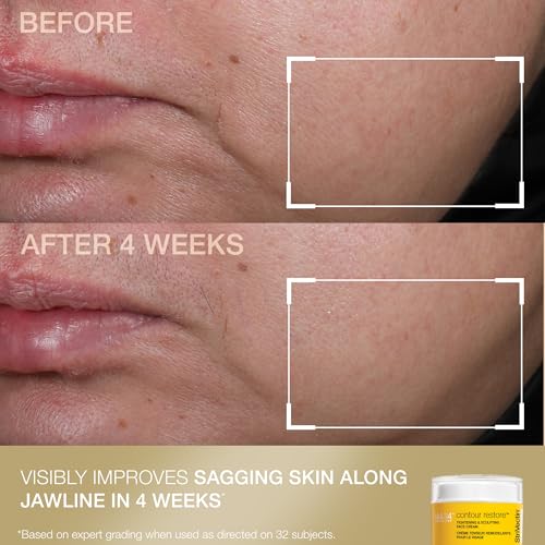 StriVectin Tighten and Lift Advanced Neck Cream PLUS with Alpha-3 Peptides for Neck and D?collet?, Smoothing Look of Wrinkles and Fine Lines, Improves Crepey Skin and Vertical Lines