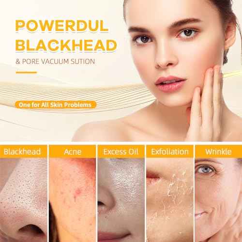 2025 Pore Vacuum with Camerafor, USB Rechargeable Blackhead Remover Vacuum,3 Levels Adjustable Pore Vacuum Blackhead Remover, 6 Suction Heads,Face Vacuum Pore Cleanser for Women & Men