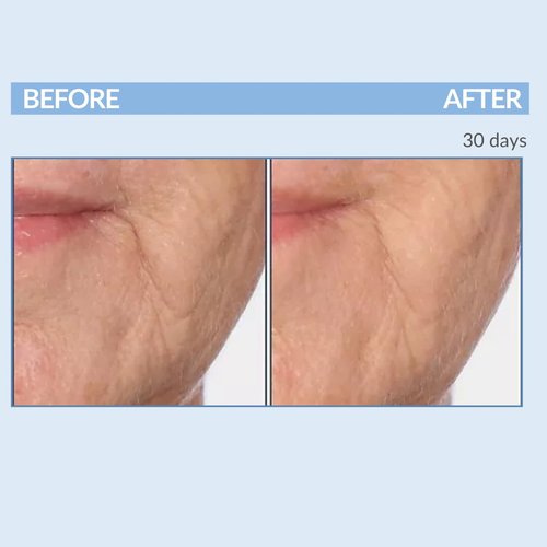 Serious Skincare A Force XR Serum Retinol Concentrate - Vitamin A - Time Released – Lightweight Anti-Aging & Anti-Wrinkle Facial Treatment – Green Tea Leaf Extract - 2 oz.