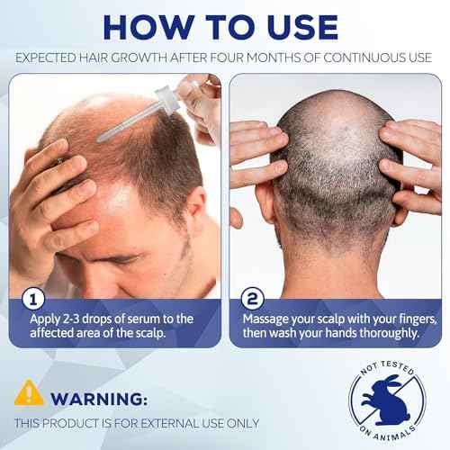 5% Minoxidil for Men and Women, Hair Regrowth Treatment for Thinning Hair and Hair Loss, Topical Solution - 1 Months Supply - Dermatologist recommended (Pack of 1)