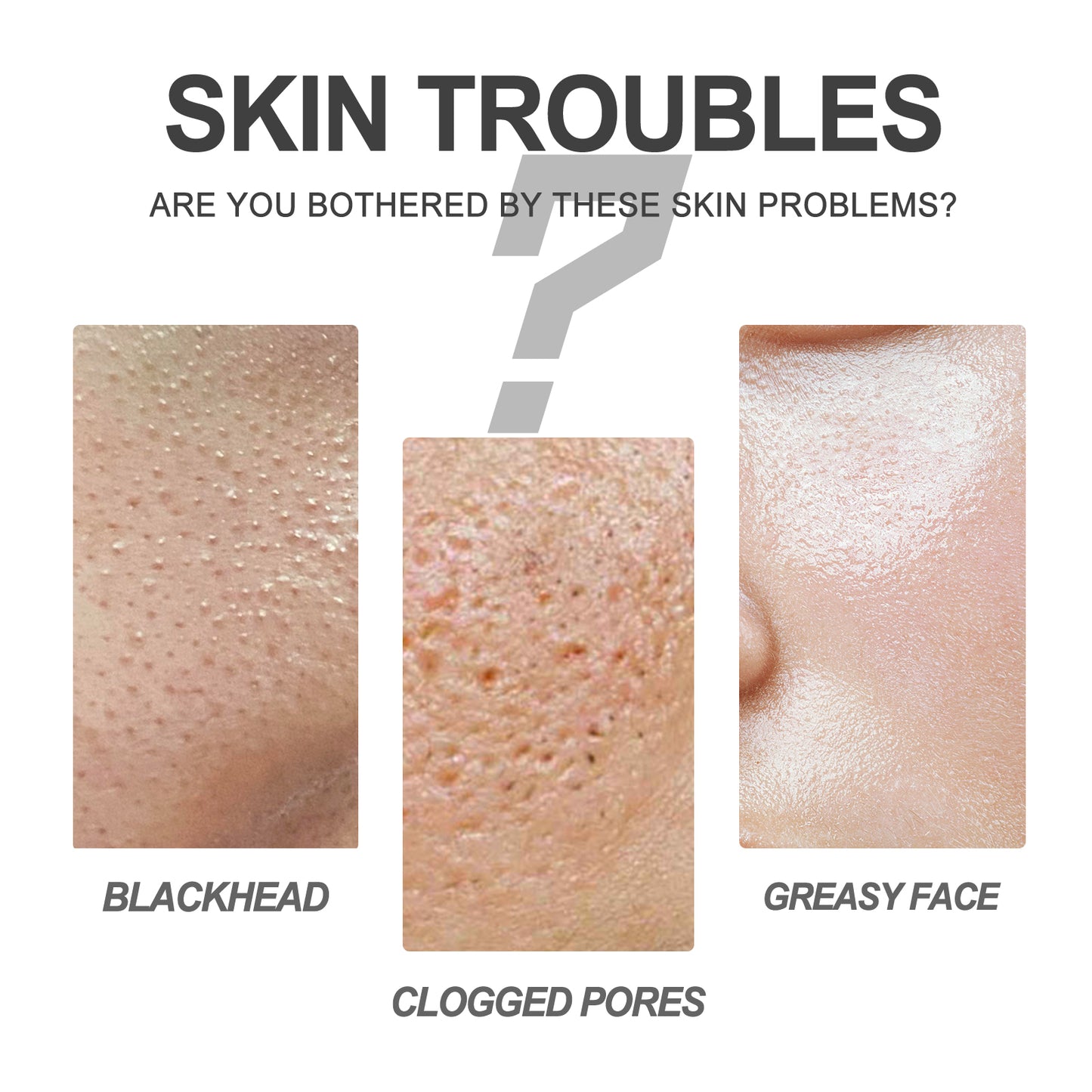 Blackhead Removal Cream & Pore Cleansing Patch Set