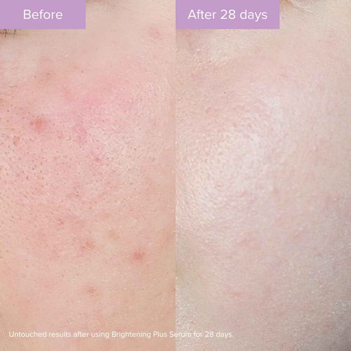 The Organic Pharmacy Brightening Plus Serum, 35ml - with Niacinamide, Enzymes, Orange Peel Oil (Formerly Rose Plus Brightening Complex)