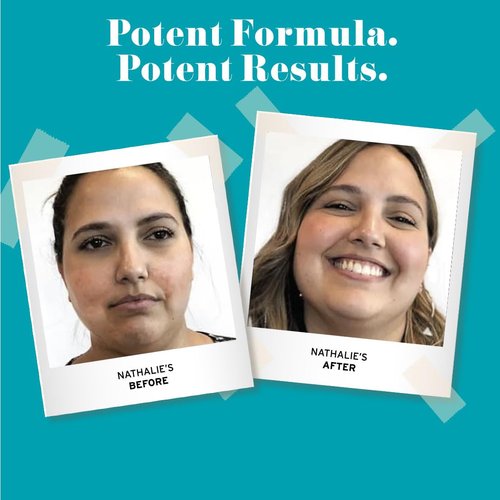 No Bad Stuff - Niacinamide Serum - Rejuvenates, Smooths, + Restores Skin with Vitamin B3, Hyaluronic Acid, and Aloe Vera (1 oz)