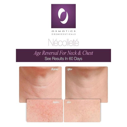 Osmotics Nécolleté Age Reversal for Neck and Chest - Firms, Smooths & Tightens Fragile Skin on Neck, Chest & Décolleté | Anti-Aging Formula for Sun Damage - 1.7oz