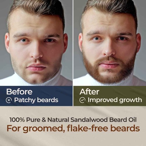 Gya Labs Sandalwood Beard Oil for Men Growth - 100% Pure Natural Beard Growth Oil for Men with Organic Argan & Jojoba - Moisturizes, Softens & Strengthens (1 Fl Oz x 3)