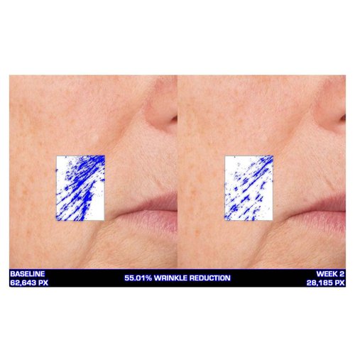 Serious Skincare Ultra-Mare Pure Marine Infusion Facial Serum - Encourages Collagen Production, Cell Turnover and Plumper Skin - Niacinamide - Acid Free - Concentrated 2 oz.