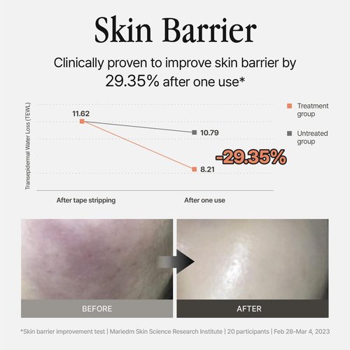 Groundplan Silver Shield Mist - Facial Barrier Toner Spray, 80% Witch Hazel Water, Centella Asiatica for Skin Barrier Repair, Recovery Calming Mist for Sensitive Skin, Korean Skin Care (11.16 fl oz)