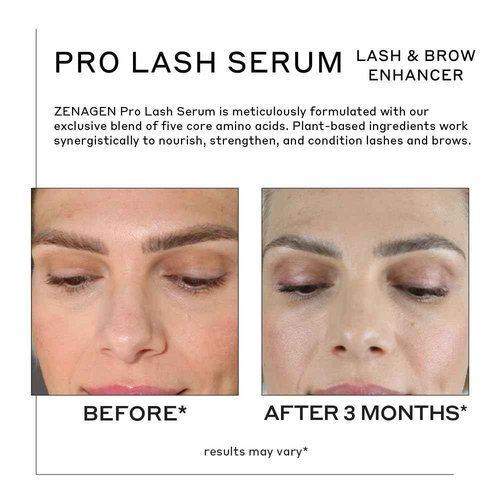 ZENAGEN Pro Lash Serum | Promotes Longer, Thicker Lashes, Strengthens & Nourishes Hair Follicles, Lightweight Non-Irritating Formula, Vegan, Plant-Based, 4ml