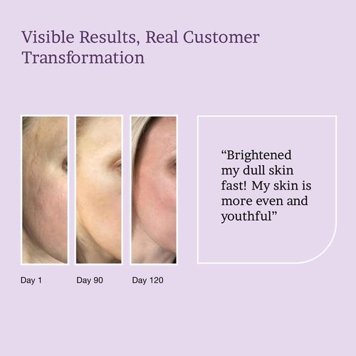 MAXDAHLIA Petal Peel - 20% AHA Serum | Mandelic & Lactic Acid | Resurfacing & Renewing Overnight Treatment for Dark Spots, Uneven Skin Tone & Acne Scar Remover