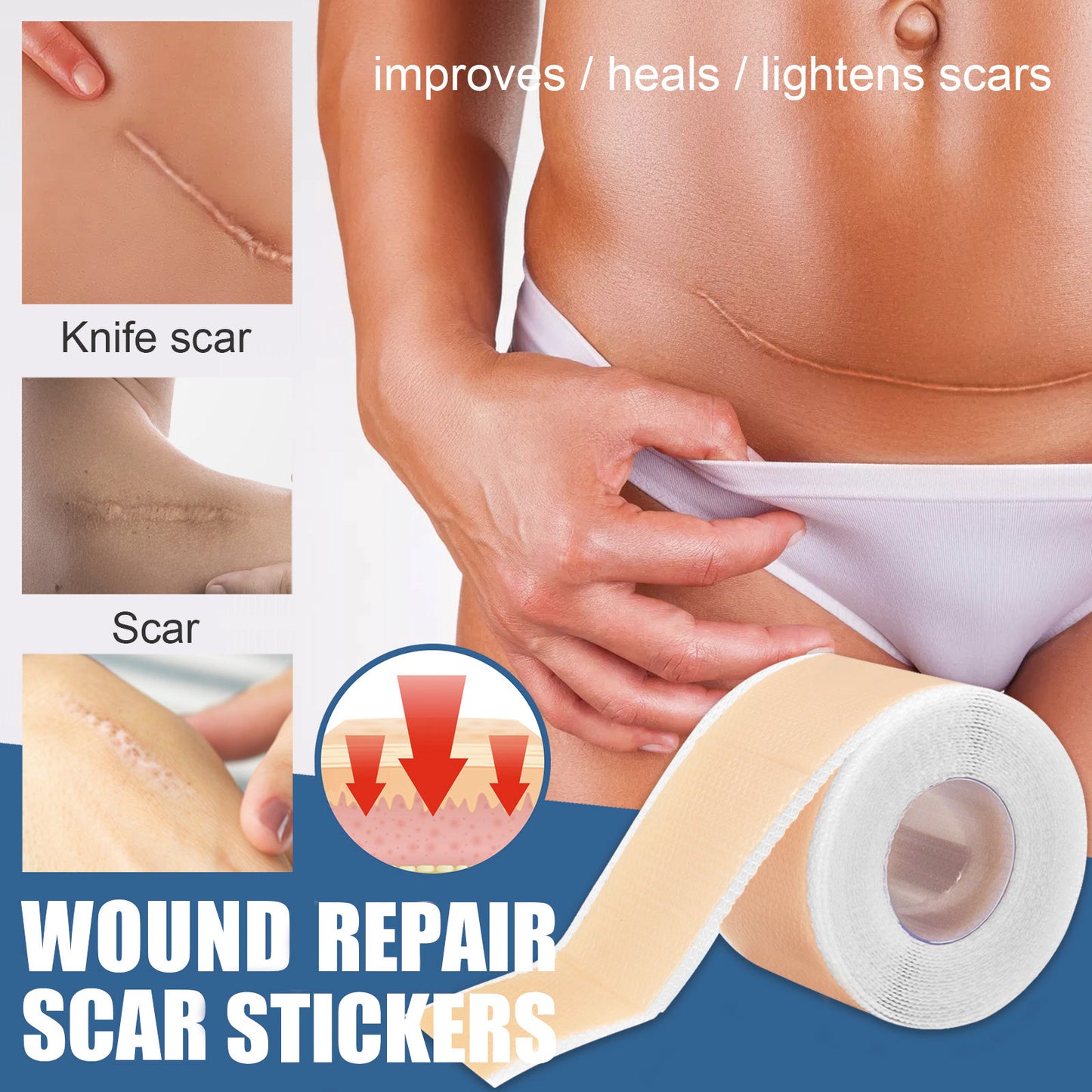 Silicone Scar Repair Patches for Skin Blemish Treatment