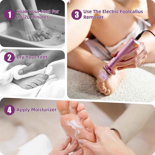 YPWRENH Electric Foot Callus Remover: Feet File Callus Remover- Dead Hard Skin Foot Scrubber -3 Adjustable Speed Pedicure Tools for Feet