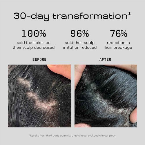 Jupiter Anti Dandruff Shampoo, Conditioner & Serum for Flaky, Itchy, Oily & Dry Scalp - Nourishes Scalp, Reduces Breakage & Flakes - Color-Safe, Sulfate-Free, Paraben-Free